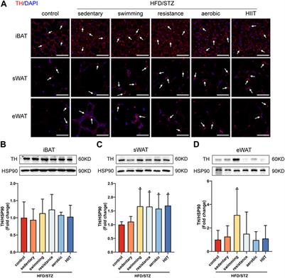 Depot-specific adaption of adipose tissue for different exercise approaches in high-fat diet/streptozocin-induced diabetic mice